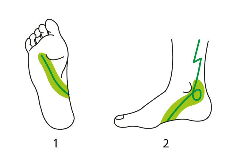 schemas_phytoenergetique_rein